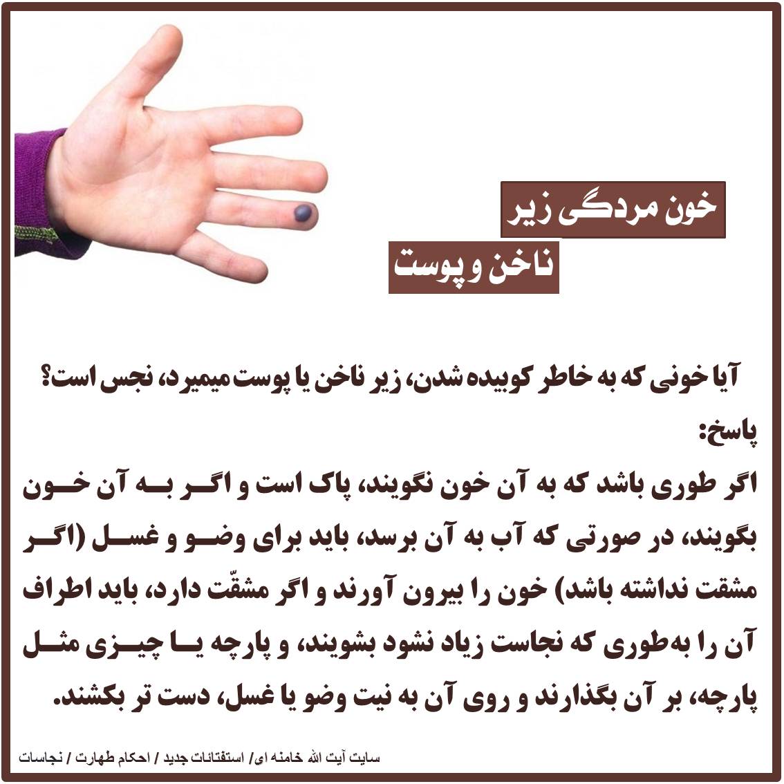 خون مردگی زیر ناخن و پوست نجاست