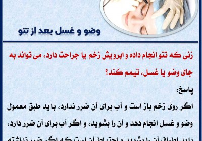 وضو و غسل بعد از تتو جبیره